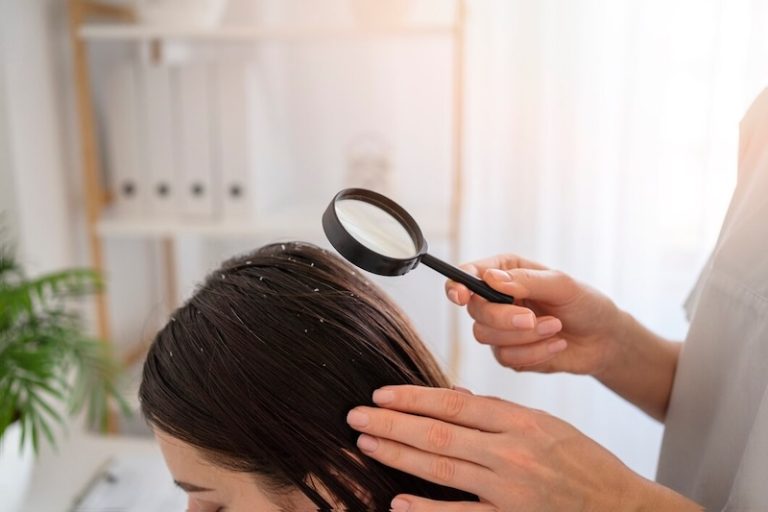 De 7 Beste Anti Roos Shampoos van 2026