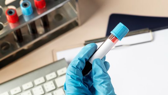 zuurstofgehalte-in-bloed